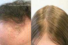 eXTreme Max Hair Piece Adhesive