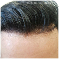 Men's hairpieces injected with Remy human hair (0.03mm base thickness)